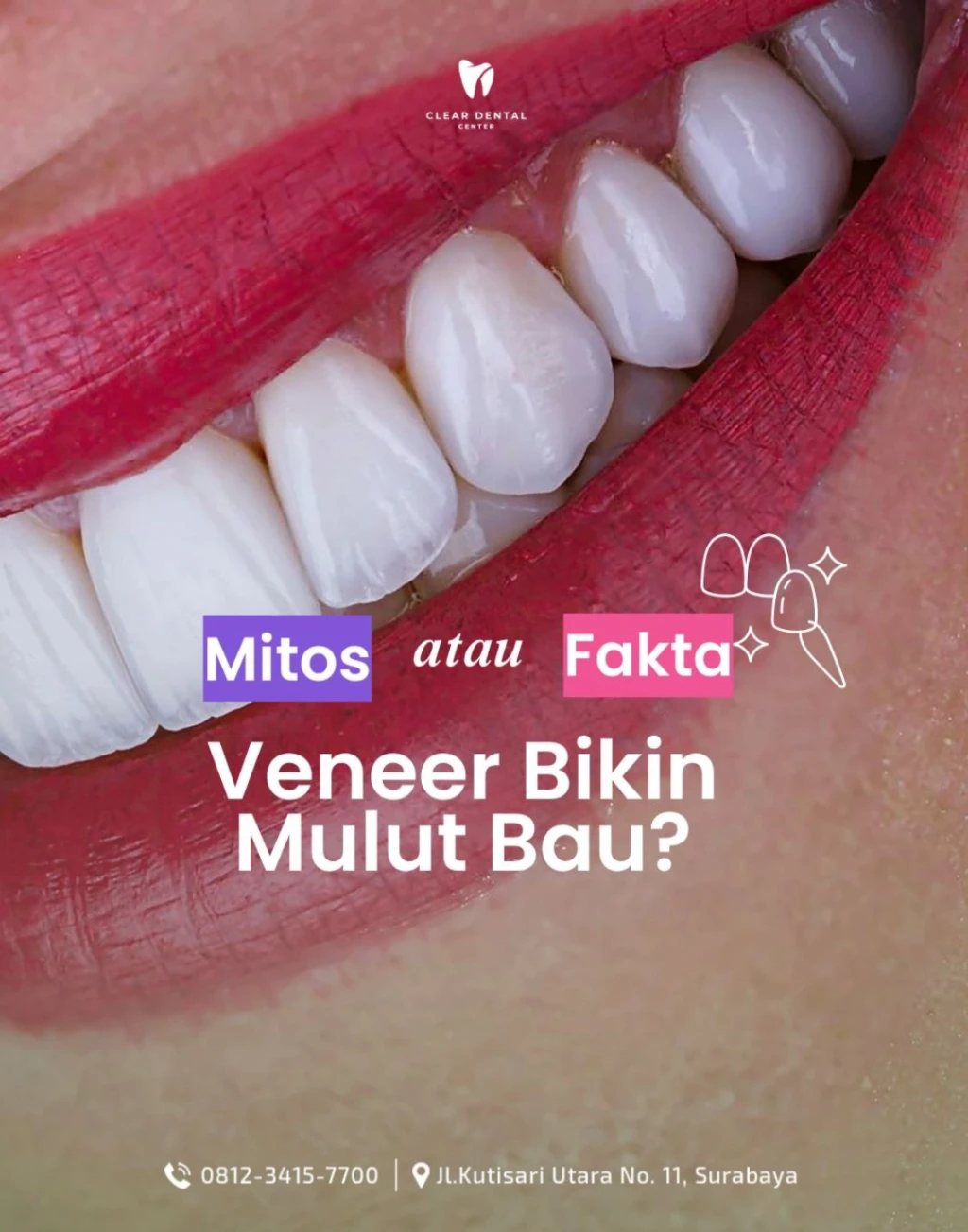 Bener Nggak Sih? Atau Cuma Mitos Belaka?